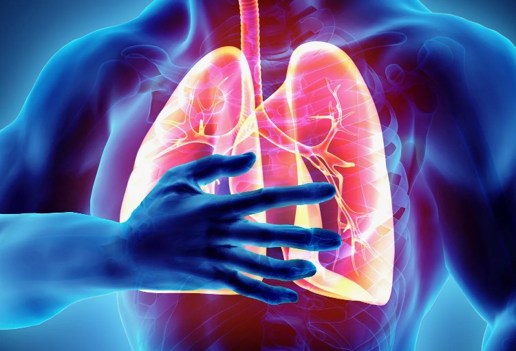 Що таке легенева гіпертензія